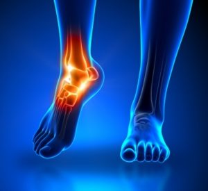 A person's foot is shown with a broken bone, causing intense pain.