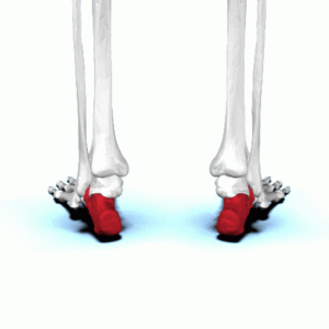 A pair of skeletons with a red heel and toe.