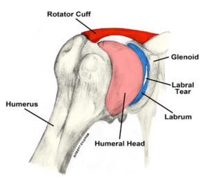 A diagram of the rotator cuff and labrum.