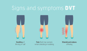Signs and symptoms of thrombosis.